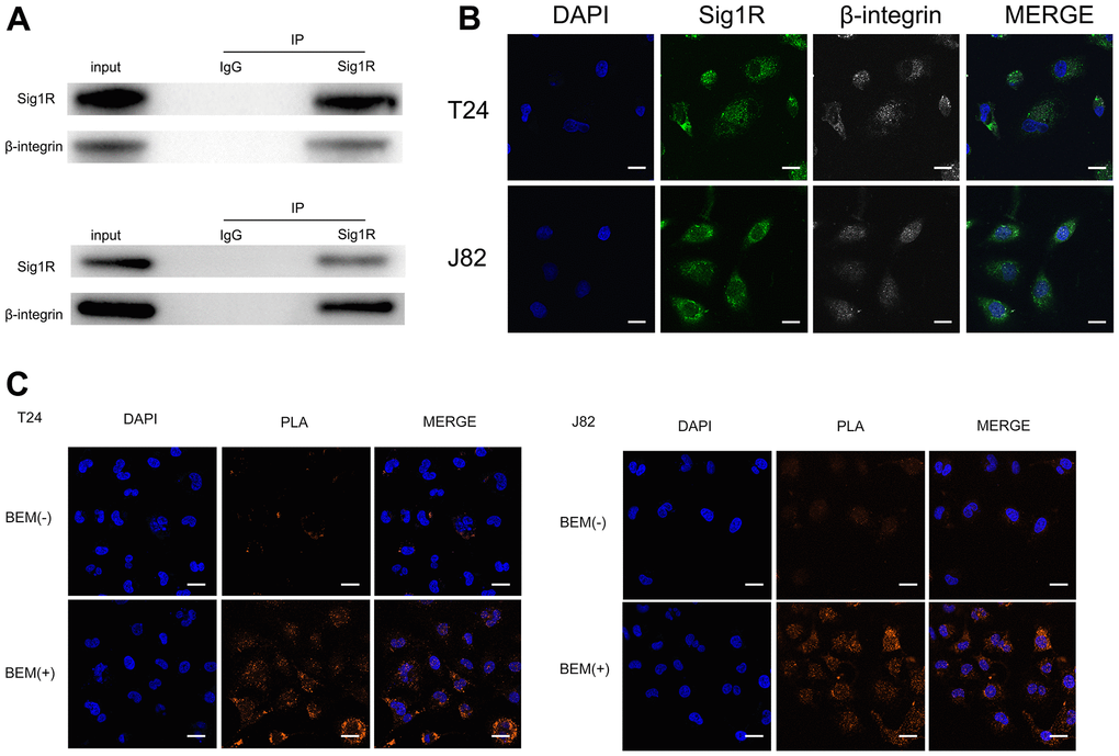 Sig1R is associated with β-integrin. (A) Co-IP analysis showed the interaction between Sig1R and β-integrin in T24 and J82 cells. Sig1R and β-integrin were immunoprecipitated using antibody against β-integrin. IgG was used as a negative control. (B) Immunofluorescence staining analysis showed the colocalization of Sig1R and β-integrin in T24 and J82 cells, scale bar = 20 μm. (C) Representative images of Duolink In Situ PLA show that there is a direct interaction between Sig1R and β-integrin, and the effect of the two is significantly enhanced after BEM hydrogel coating (orange point), scale bar = 20 μm.