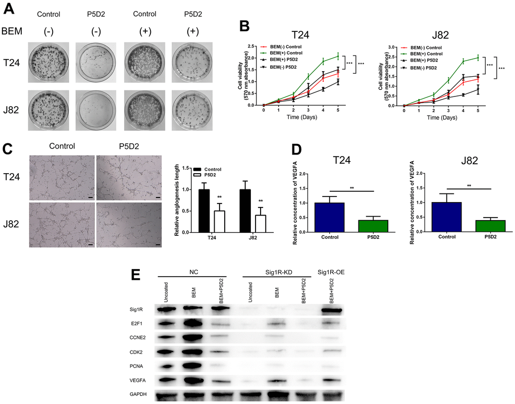 β-Integrin mediates BEM-induced bladder cancer cell proliferation. (A) P5D2 treatment and control T24 and J82 cells were incubated with BEM hydrogels (0 and 20 mg/mL) for 2 weeks and allowed to form colonies. (B) The viability of treated P5D2 and control bladder cancer T24 and J82 cells incubated with BEM hydrogels (0 and 20 mg/mL) for 4 days was evaluated using the MTT assay. (C) P5D2 inhibited tumor-induced HUVEC angiogenesis according to tube formation assay in BEM, scale bar = 100 μm. (D) Quantification of VEGFA concentration in CM are shown. (E) Total protein extracts from NC, Sig1R-KD, or Sig1R-OE K562 cells plated on uncoated or BEM-coated dishes in the presence or absence of P5D2 were separated by SDS-PAGE and immunoblotted with Sig1R, E2F1, CCNE2, CDK2, PCNA, and VEGFA antibodies. **p 