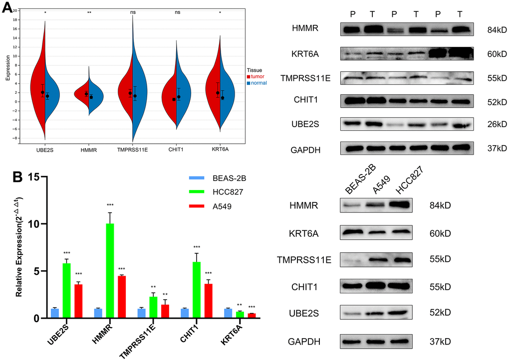 The expression validation of the genes in the FA score by RT-qPCR and WB. (A) Expression levels of 5 genes in LUAD and matched paracancerous tissues. (B) Expression levels of 5 genes in the normal lung epithelial cell line BEAS-2B and two LUAD cell lines (HCC827, A549). ns, not significant, *P 