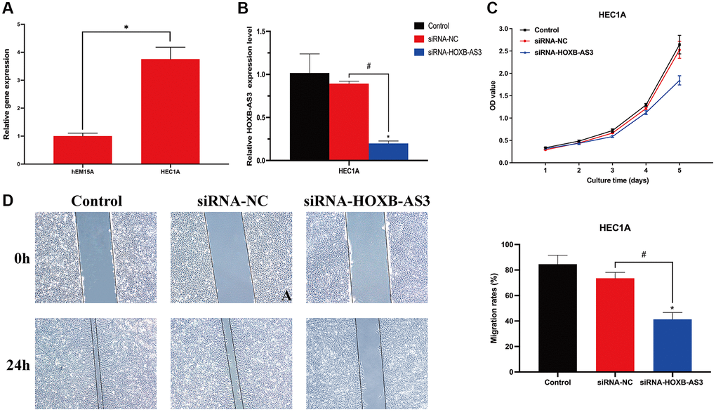 Role of lncRNA HOXB-AS3 in UCEC cells. (A) QRT-PCR analysis of SNCG. (B) The expression level of HOXB-AS3 in HOXB-AS3 inhibition model. (C) MTT assay. (D) Wound-healing assay.