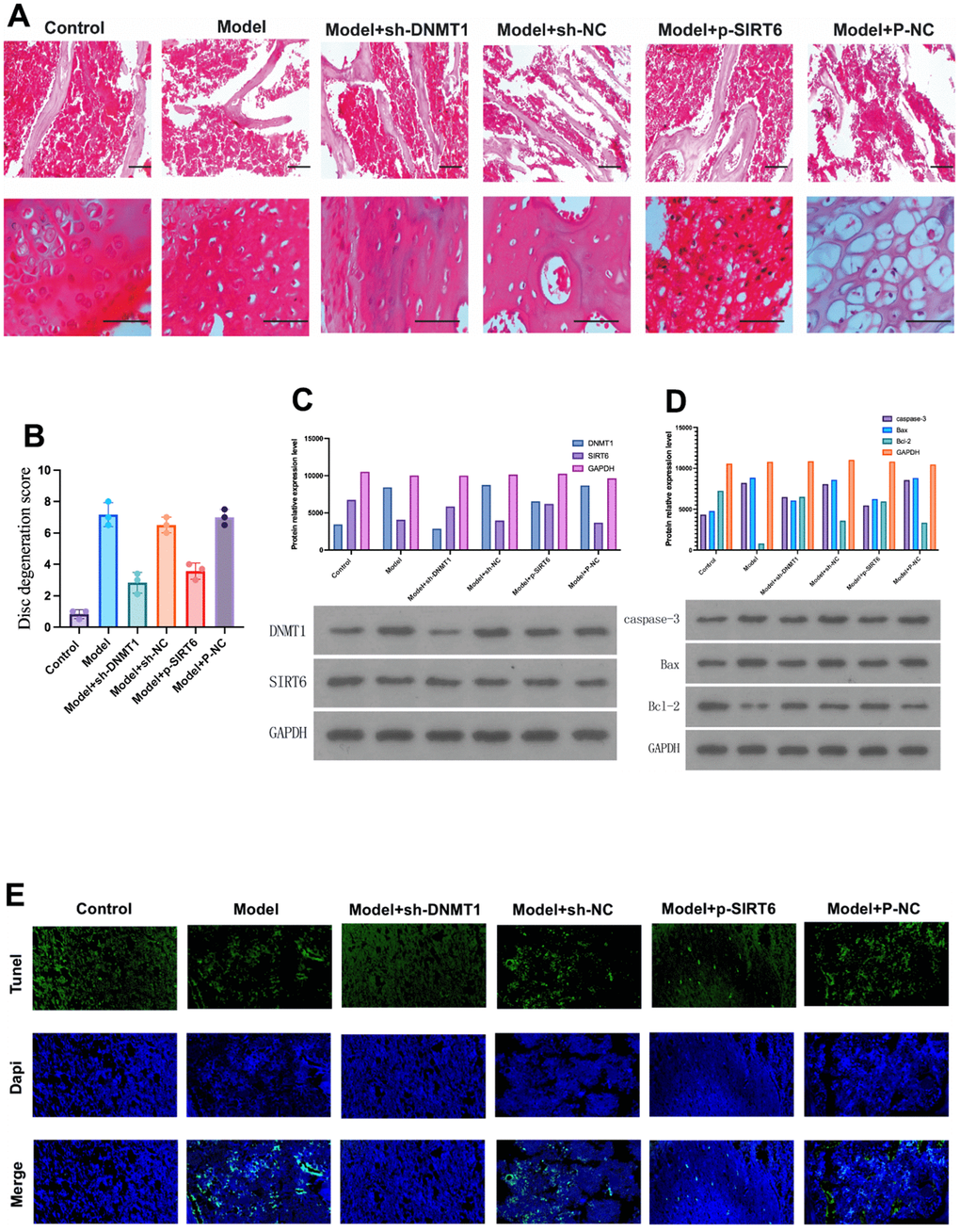 DNMT1 was up-regulated and the expression of SIRT6 was down-regulated in the nucleus pulposus tissue of IDD rats. (A) Hematoxylin and eosin stain were used to detect the damage to the nucleus pulposus tissue of the rats in each group at 12 weeks. (B) Histological damage score significantly increased in the model group and was improved by inhibition of DNMT1 and overexpression of SIRT6 respectively (pC) Protein relative expression level of DNMT1 detected by western blot. (D) Western blot detection of apoptosis-related proteins including caspase-3, BAX, and BCL-2. DNMT1 inhibition and SIRT6 overexpression significantly inhibited apoptosis pE)TUNEL apoptosis assay of nucleus pulposus cells.