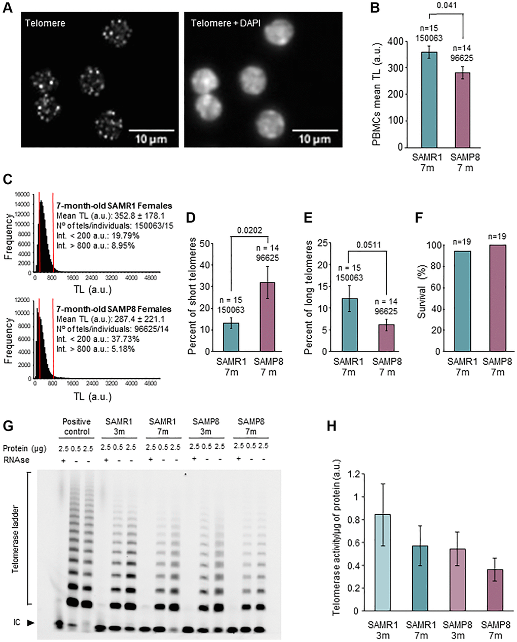 Analysis of telomere length in PBMCs and telomerase activity in ovary. (A) The micrographs show representative images of telomere HT-qFISH (white dots, left panel) and the merge (DAPI and telomeres, right panel) on PBMCs. (B) Mean TL of PBMCs, analyzed by HT-qFISH, in 7-month-old SAMP8 and SAMR1 females. (C) Telomere-length frequency histograms in 7-month-old controls (top panel) and age-matched SAMP8 females (lower panel). (D) Percent of short telomeres in PBMCs of 7-month-old SAMP8 and SAMR1 females. (E) Percent of long telomeres in PBMCs of 7-month-old SAMP8 and SAMR1 females. (F) The graph shows the percent of survival at 7 months of age in SAMP8 females and controls. (G) The micrograph shows telomerase activity assay from ovarian extracts of SAMP8 and SAMR1 females at 3 and 7 months of age. Two protein concentrations (0.5 and 2.5 μg) of the same ovarian extract from each mouse are shown. (H) Quantification of the telomerase activity TRAP assay shown in G. n indicates the number of mice analyzed. Underneath, the number of telomere spots analyzed is indicated. The S.E.M. is represented in error bars (B, D, E and H). Statistical significance was determined Mann-Whitney U test (B, D and E) and Fisher’s exact test (F). Abbreviation: IC: Internal Control. Scale bars are 10 μm.