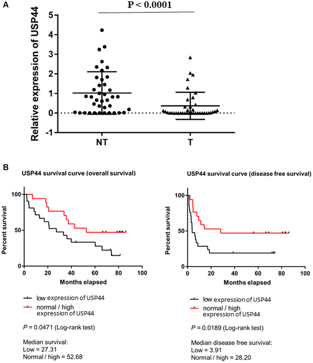 Low expression of USP44 is a prognostic factor in hepatocellular carcinoma (HCC). (A) USP44 expression in 40 pairs of HCC nontumoral (NT) and tumoral (T) tissues. USP44 expression was lower in tumoral tissues than in nontumoral tissues (p B) Correlation between USP44 expression and survival rate of patients with HCC. Low USP44 expression was related to shorter overall survival (p = 0.047) and disease-free survival (p = 0.019) in patients with HCC. The x-axis indicates survival time in months. The y-axis indicates survival probability. The log-rank p USP44 expression is significantly associated with prognosis in HCC.