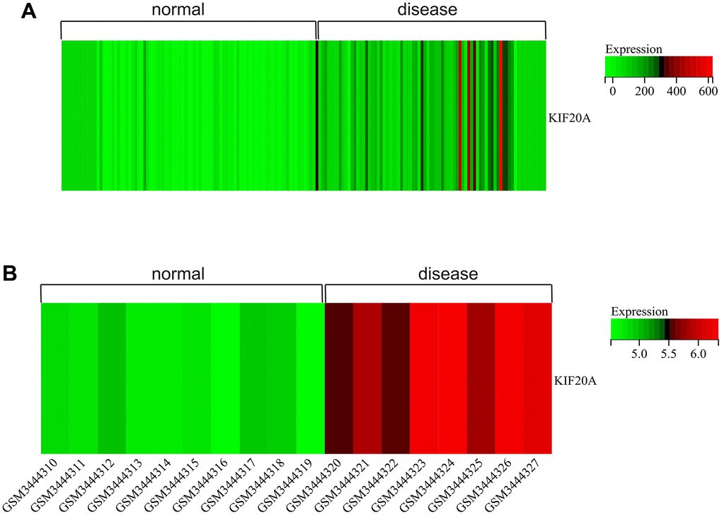 Heatmap. (A) GSEGSE14762, GSE53757. (B) GSE121711.