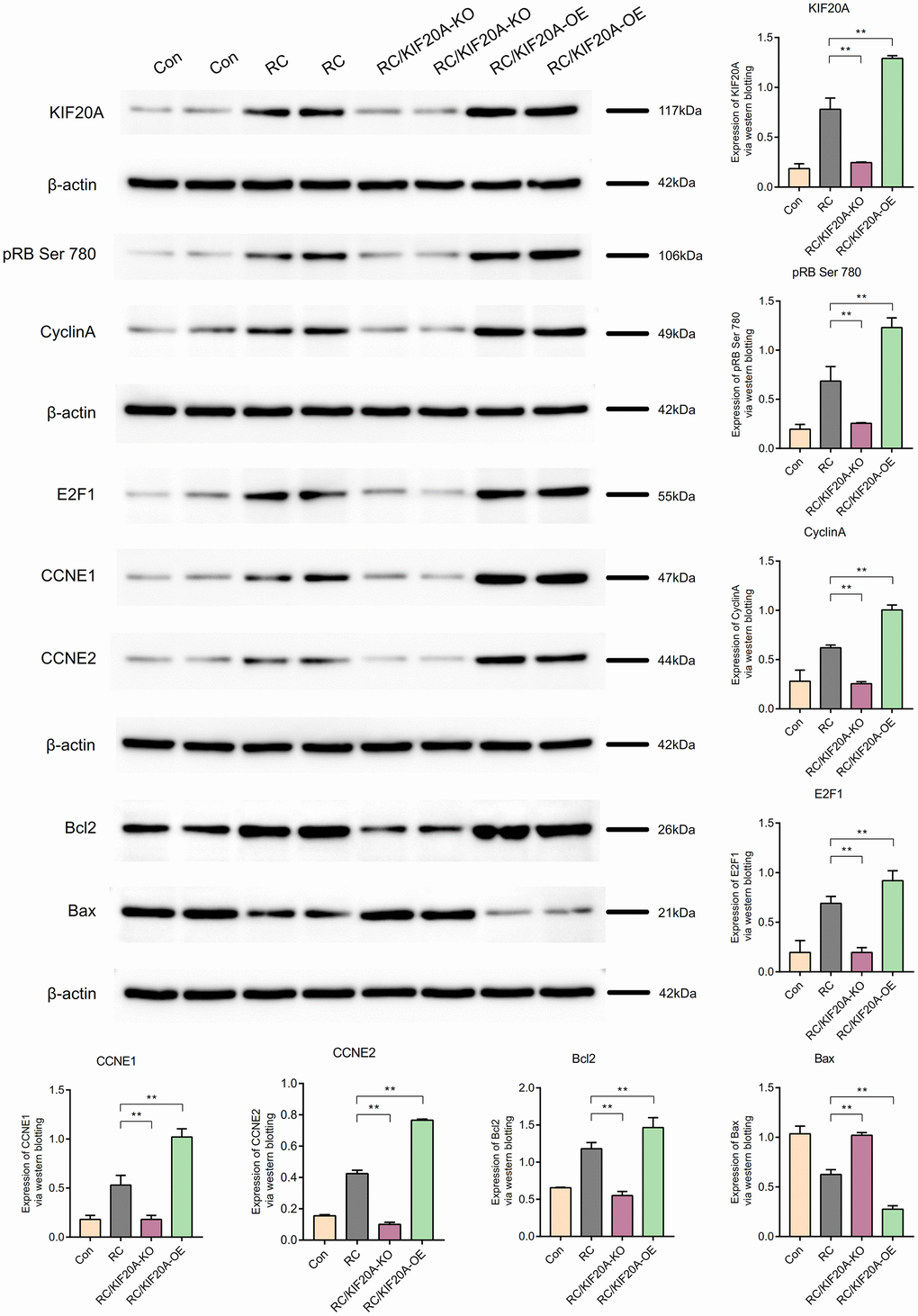 KIF20A might inhibit apoptosis in RCs via the pRB Ser 780/CyclinA signaling pathway.
