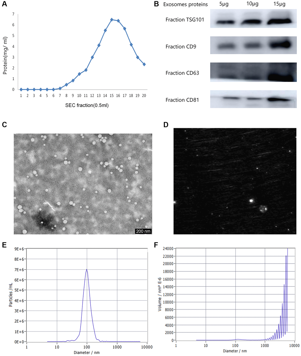 Various characterizations of plasma exosomes. (A) The content of plasma proteins in 0.5 mL fraction sample. (B) Western blot analysis of the typical exosomal proteins, TSG 101, CD9, CD63 and CD81. (C) Transmission electron microscopy (TEM) image indicating exosome morphology. (D) A representative laser scattering microscopy image of isolated exosomes. (E) The Nanoparticle tracking analysis (NTA) result of the particle size distribution for isolated exosomes. (F) The size distribution of volume consistent with the size range of exosomes.