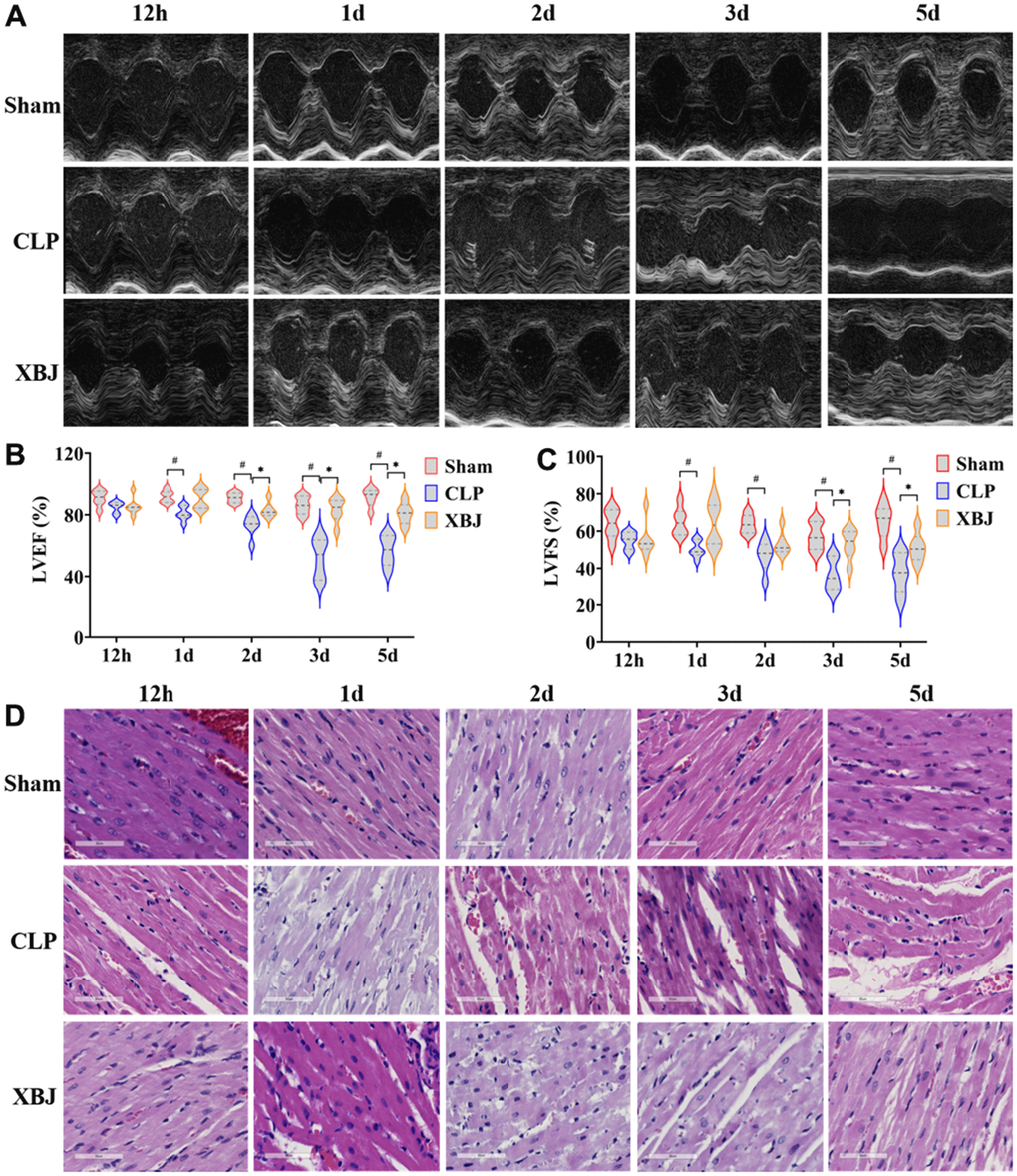 Effects of XBJ on sepsis-mediated myocardial dysfunction at 12h, 1d, 2d, 3d and 5d after CLP. (A) Representative echocardiographic images. (B, C) Quantification of LVEF, LVFS via echocardiography. (D) Histological analysis of heart via H&E staining (200×).