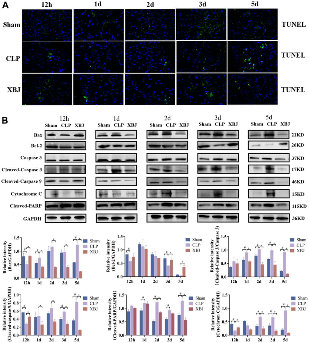 Effects of XBJ on sepsis-mediated cardiomyocyte apoptosis at 12h, 1d, 2d, 3d and 5d after CLP. (A) Representative images show apoptosis of heart tissue was detected by TUNEL staining. (B) Representative images and relative intensity of western blot for Bax, Bcl-2, Caspase 3, Cleaved-Caspase 3, Cleaved-Caspase 9, Cytochrome C and Cleaved-PARP.