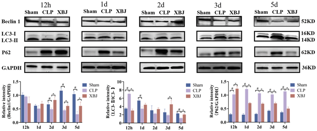 Effects of XBJ on sepsis-mediated cardiomyocyte autophagy at 12h, 1d, 2d, 3d and 5d after CLP. Representative images and relative intensity of western blot for Beclin-1, LC3-II/LC3-I and P62.