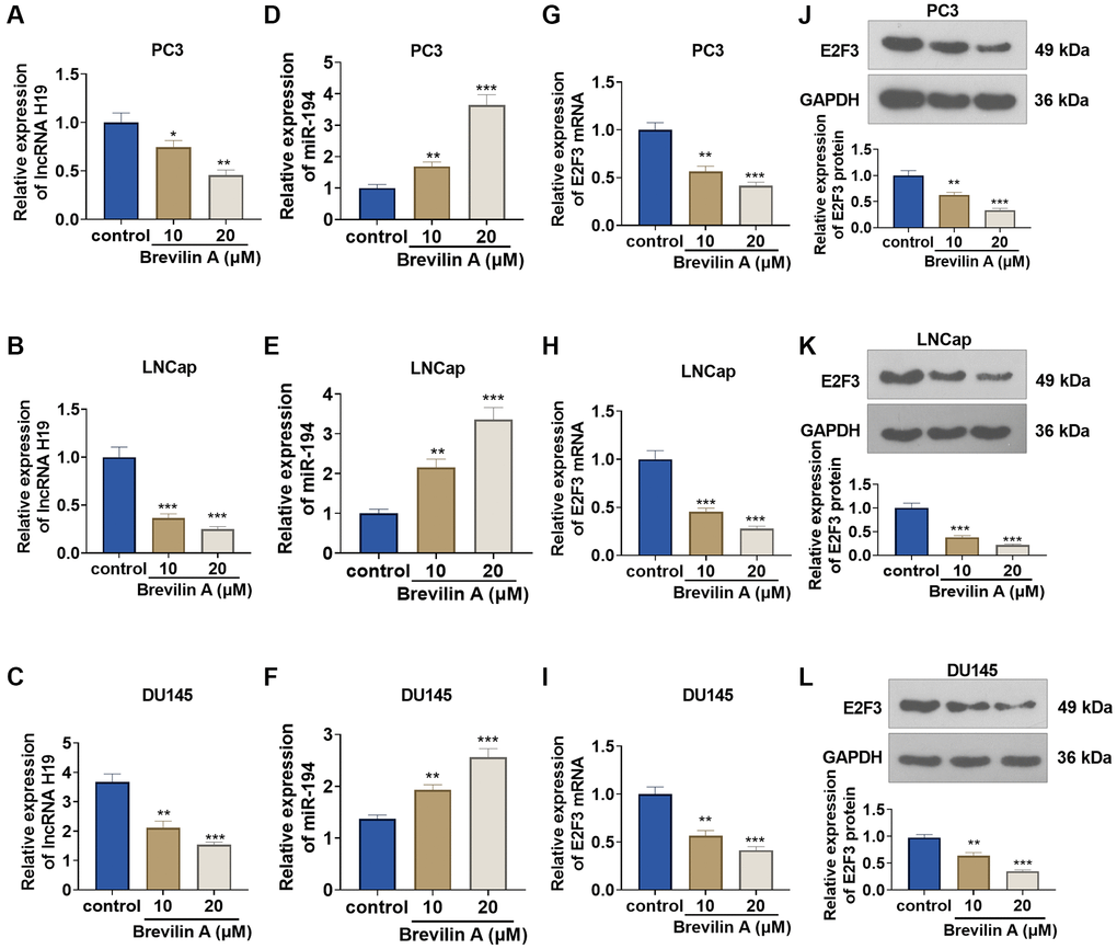 The impact of Brevilin A on lncRNA H19, miR-194, and E2F3 expressions. DU145 cells were treated at the concentrations of 10 μM and 20 μM, which were calculated through the IC50 values of Brevilin A. (A–I) qRT-PCR determined lncRNA H19 (A–C), miR-194 (D–F) and E2F3 mRNA (G–I) expressions. (J–L) Western blot measured E2F3 expression. *P **P ***P n = 3.