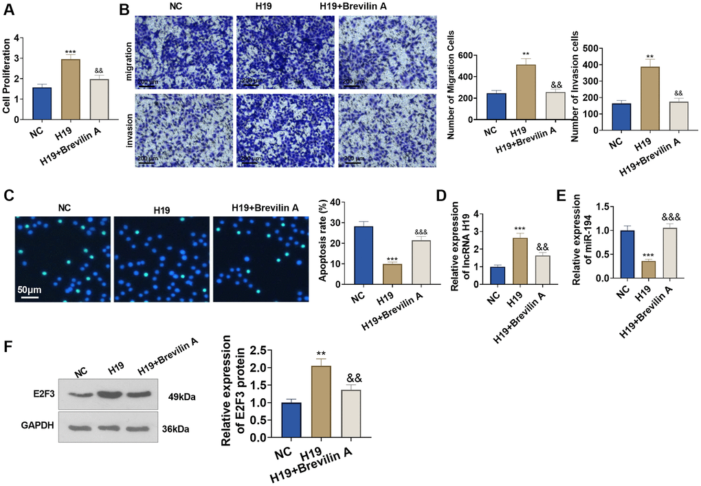Brevilin A hampered the pro-cancer function of lncRNA H19. Brevilin A was utilized to treat DU145 cells stably transfected with lncRNA H19 overexpression plasmids. (A) CCK8 assay checked cell proliferation. (B) Transwell assay examined cell migration and invasion. Scale bar = 100 μm. (C) TUNEL staining detected cell apoptosis. Scale bar = 50 μm. (D, E) qRT-PCR examined the profiles of lncRNA H19 and miR-194. (F) Western blot was used for examining E2F3 protein level. **P ***P &P &&P &&&P n = 3.