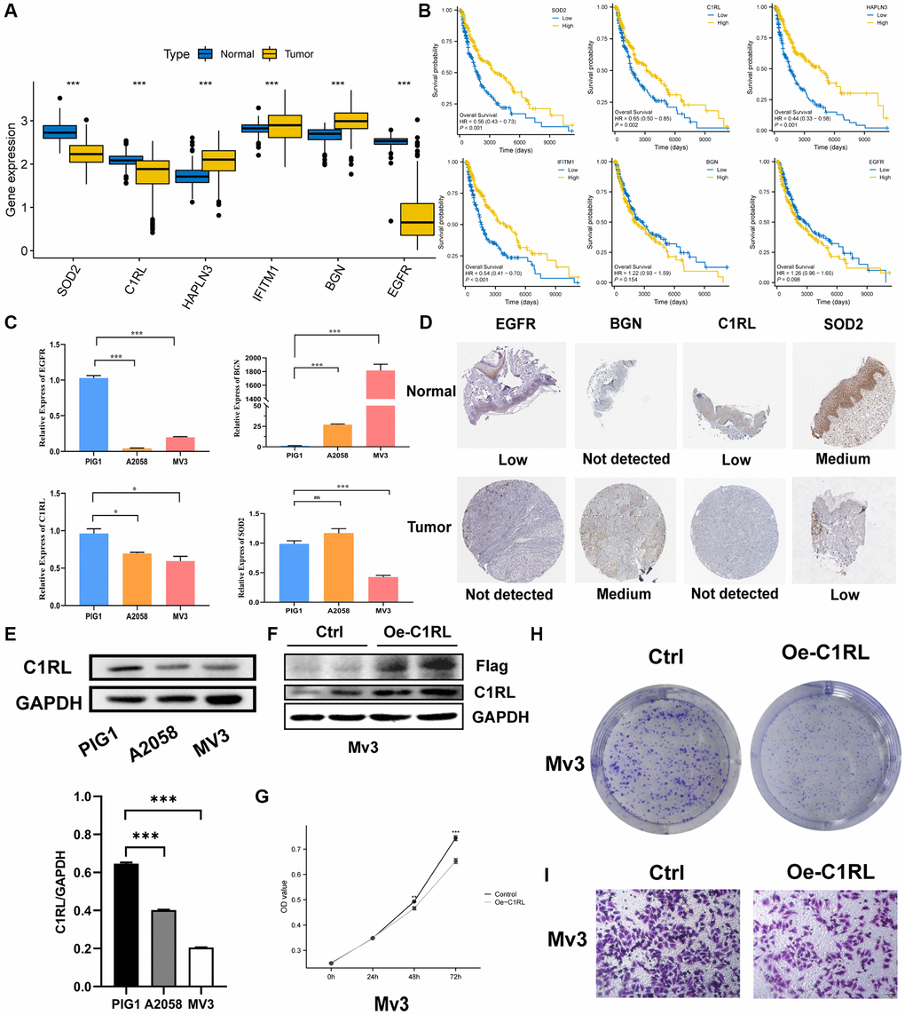 Prognostic TRGs gene expression levels in tumor and normal cells and functional analysis. (A) Different expressions of the six signature genes between the normal and tumor tissues (TCGA AND GTEx). (B) Confirmation of prognostic value of 6 TRGs for patients in TCGA by Kaplan–Meier analysis. (C) The relative RNA levels of EGFR, BGN, C1RL AND SOD2 in normal skin melanocyte and melanoma cell lines by q-PCR. (D) The IHC staining showed 4 signature genes expression at the protein level. (E) The protein level expression of C1RL genes based on melanocytes (PIG1) and melanoma cells lines (A2058 and MV3) by Western blot. (F) Western blot is used to assess the Overexpression efficiency of in MV3. CCK8 (G) and colony formation assay (H) are performed to assess effects of C1RL Overexpression on proliferation of MV3. (I) Transwell assay is utilized to evaluate the migration.