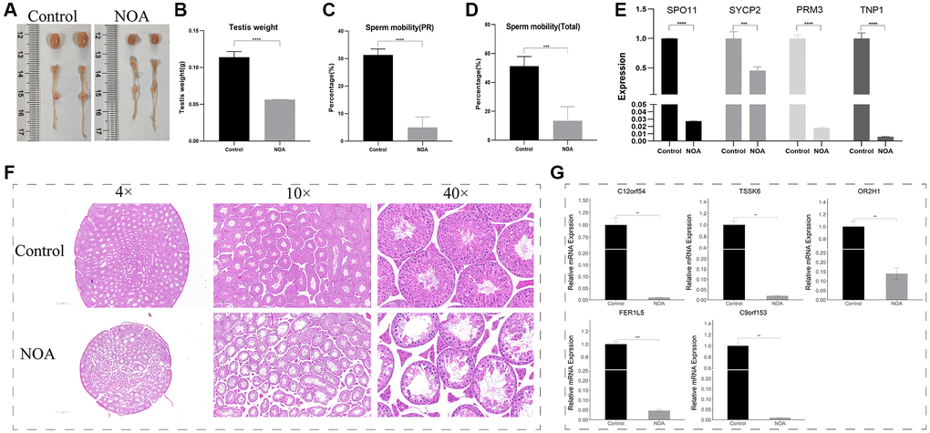 Animal NOA model construction and experiment validation in testis (NOA: irradiation-induced non-obstructive azoospermia mice, Control: control group). (A) Photographs of testis and epididymis. (B) Testis weight (g). (C) Sperm progressive motility results (PR). (D) Total sperm motility results (Total). (E) Relative mRNA expression of SPO11, SYCP2, PRM3, TNP1. (F) Testicular HE staining results (4×, 10×, 40×field). (G) Relative mRNA expression of signature genes (C12orf54, TSSK6, OR2H1, FER1L5, C9orf153) in testis. (**indicates P ***indicates P ****indicates P 