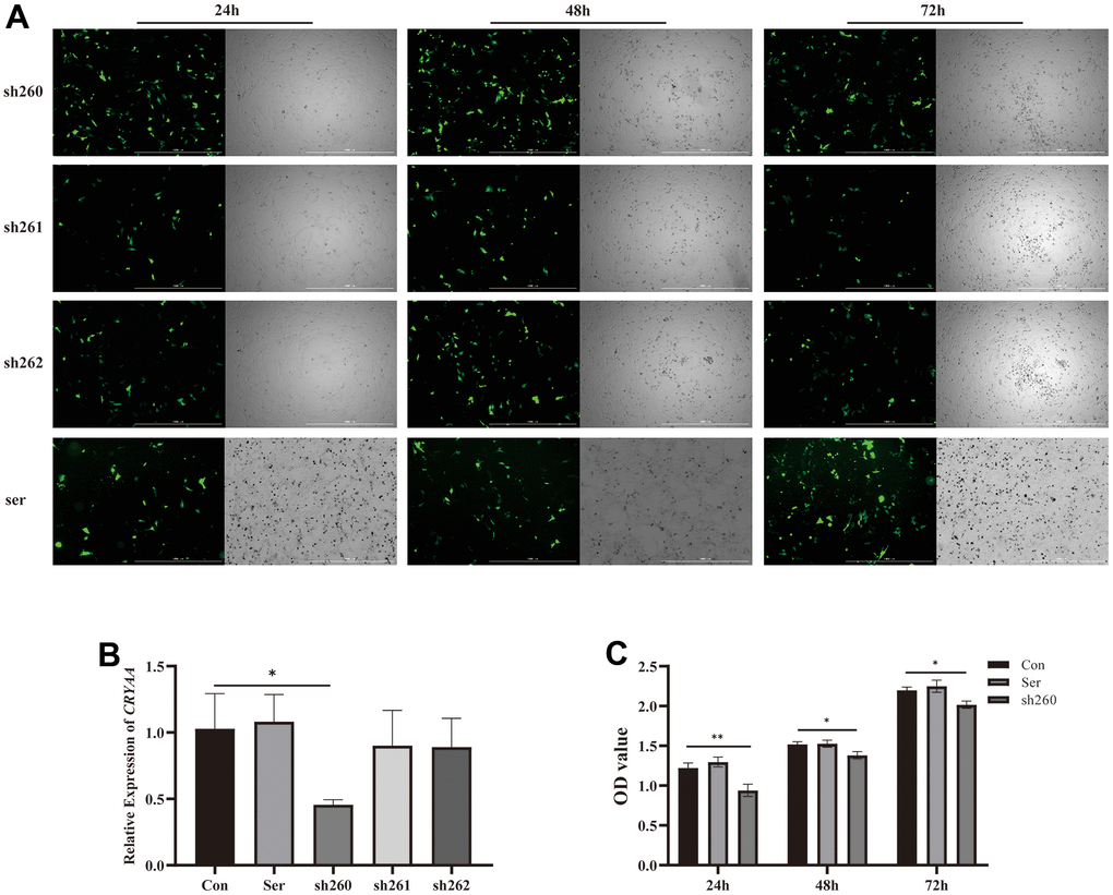 Plasmid transfection efficiency and detection of its activity. (A) Fluorescence of plasmid transfection at 24,48,72 h; (B) 48 hours sh260 CRYAA expression amount compared with the normal group, with statistical significance, * pC) Cell activity at three time periods 24, 48, and 72 after transfection, OD value of sh260 group compared with the normal group, with statistical significance, ** pp