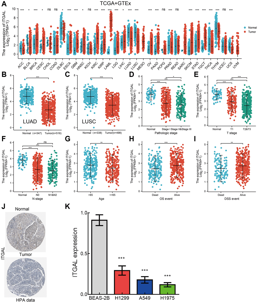 ITGAL was down-regulated in NSCLC. (A) ITGAL level in diverse cancer types by TCGA database. (B, C) ITGAL was down-regulated in NSCLC by the TCGA database. (D–I) Correlation between ITGAL expression and diverse clinical features in NSCLC by TCGA database. (J) The protein expression of ITGAL in lung cancer tissues examined by IHC assay. (K) The RNA expression of ITGAL in lung cancer cell lines examined by qPCR assay, Actin as an internal reference gene. NS > 0.05, *p **p ***p 