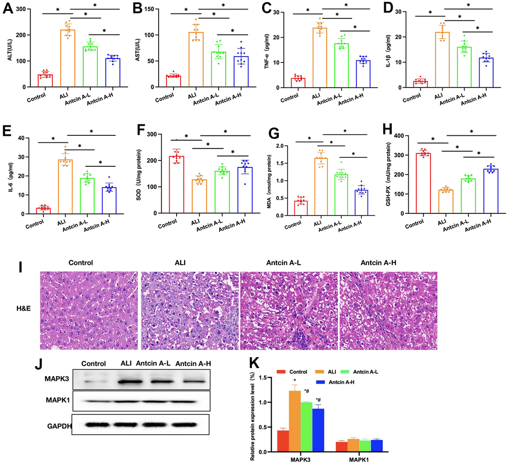 Antcin A suppresses liver injury in mice. (A, B) ALT and AST levels (n=10): The ALT and AST levels in ALI mice increased, and the differences were significant compared with Control group. Antcin A treatment suppressed liver injury, and decreased ALT and AST levels, with significant differences between groups (*PC–E) ELISA (n=10). The levels of inflammatory factors IL-6, IL-1β and TNF-α in ALI mice increased, while Antcin A treatment suppressed the expression of inflammatory factors, with significant differences between groups (*PF–H) Levels of SOD, MDS and GSH-Px (n=10). Antcin A enhanced the levels of SOD and GSH-Px, but decreased that of MDA, and there were significant difference between groups (*PI) H&E (n=5). Liver tissues developed inflammation, edema and necrosis in ALI group, with obvious cell injury, while no obvious injury was observed in Control group, and Antcin A reduced inflammatory response and cell injury in tissues. (J, K) Relative protein expression levels (n=5). Antcin A did not significantly affect MAPK1 expression, but it decreased the expression levels of MAPK3. *P#P