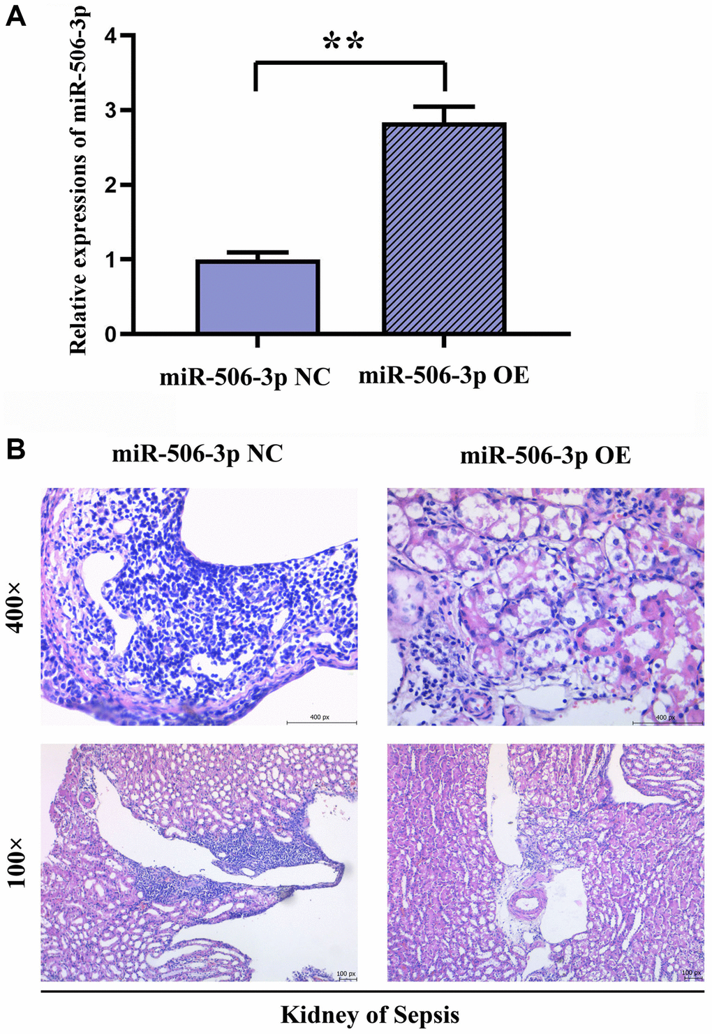 Effect of overexpression of miR-506-3p on pathological changes in kidney tissues in SA-AKI. (A) Expression of miR-506-3p in each group. (B) Through HE staining, it was found that the degree of tissue damage in the miR-506-3p OE group was significantly weakened compared with that in the miR-506-3p NC group.