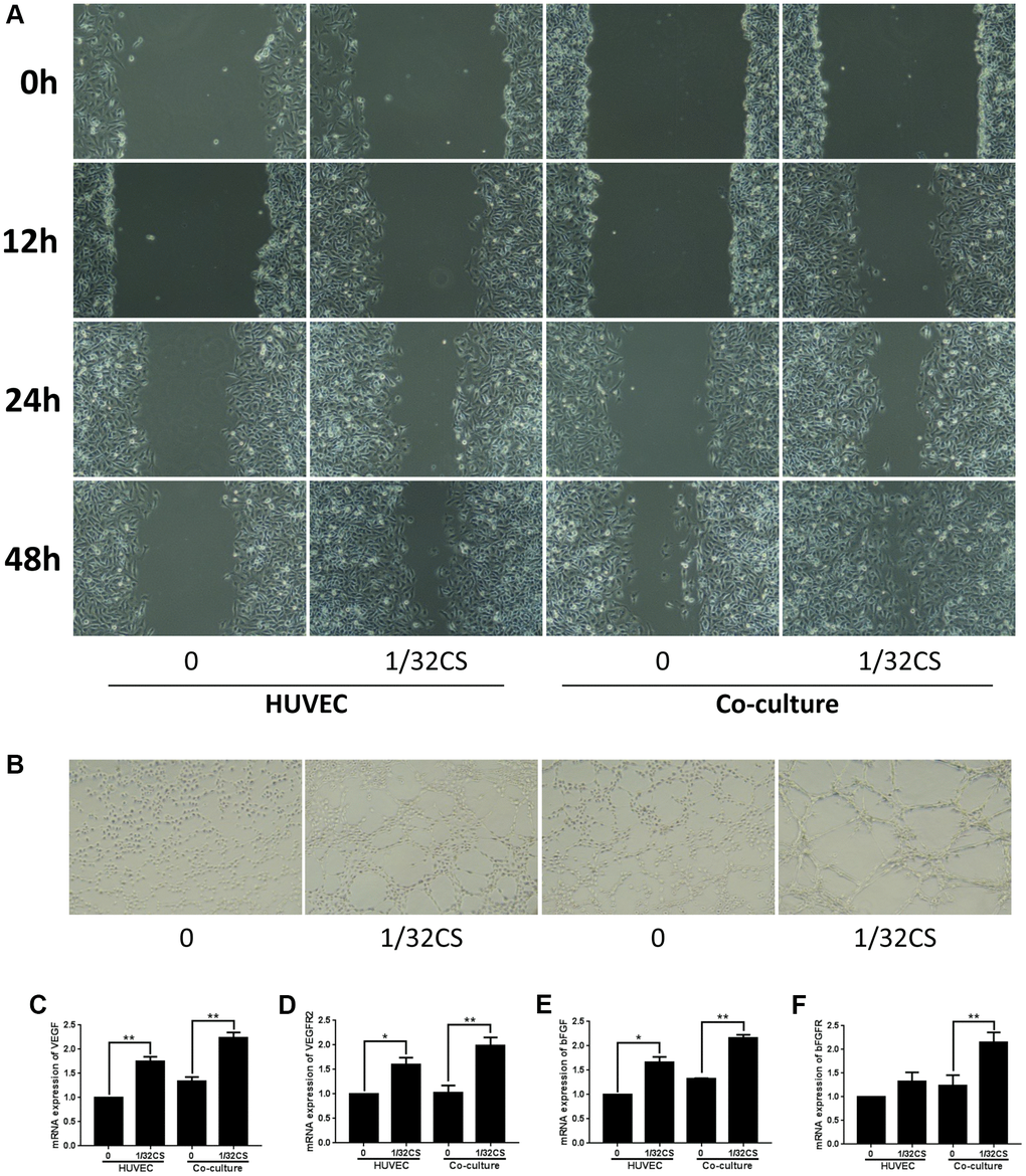 CS-stimulated ADSCs enhance migration and angiogenic capacity of HUVEC. (A–F) The HUVEC was treated with ADSCs, CS, or co-treated with ADSCs and CS. (A) The migration was measured by transwell assays in the cells. (B) The angiogenic capacity was analyzed by tube formation assays in the cell. (C–F) The levels of VEGF, VEGFR2, bFGF, and bFGFR were assessed by qPCR in the cells. Data are presented as mean ± SD. Statistic significant differences were indicated: *P **P 