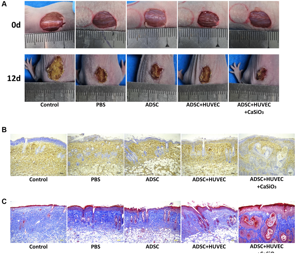 CS-stimulated ADSCs improve wound healing in full-thickness skin defect mouse model. (A–C) A full-thickness skin defect mouse model was constructed, and the mice were treated with ADSCs, ADSCs and HUVEC, or co-treated with ADSCs, HUVEC, and CaSiO3. (A) The representative images of wound area were shown. (B) The levels of CD31 were measured by immunohistochemistry. (C) The collagen deposition was analyzed by Masson’s trichrome staining.