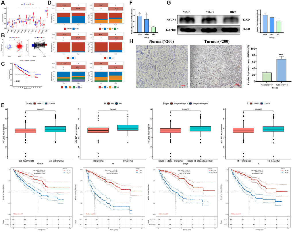 NSUN5 expression and prognostic model prediction in ccRCC. (A) The expression of 12 m5C methylation regulators between tumor tissues and normal controls. (B, C) Expression and survival curve of NSUN5 in ccRCC. (D) Relationship between NSUN5 and various clinicopathological characteristics. (E) The mRNA expression of NSUN5 and prognosis of grade, stage, M and T. (F) The expression of NSUN5 in ccRCC cell lines and HK-2 cell line. (G) The protein expression of NSUN5 in ccRCC cell lines and HK-2 cell line. (H) The protein expression of NSUN5 in ccRCC tissue and paracancerous tissue (*P **P ***P ****P 