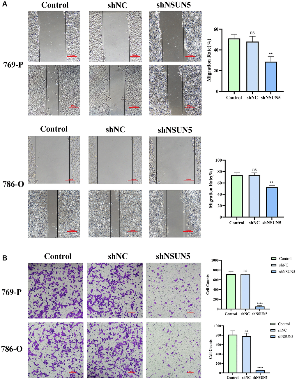 Knockdown of NSUN5 inhibited ccRCC cell migration and invasion. (A) The effect of NSUN5 on the migration of ccRCC cells was detected by wound healing assay. (B) Transwell assays were used to detect the effect of NSUN5 on the invasion of ccRCC cells (Observation under 200x). Data from one representative experiment is presented as Mean ± SEM (**P ****P 