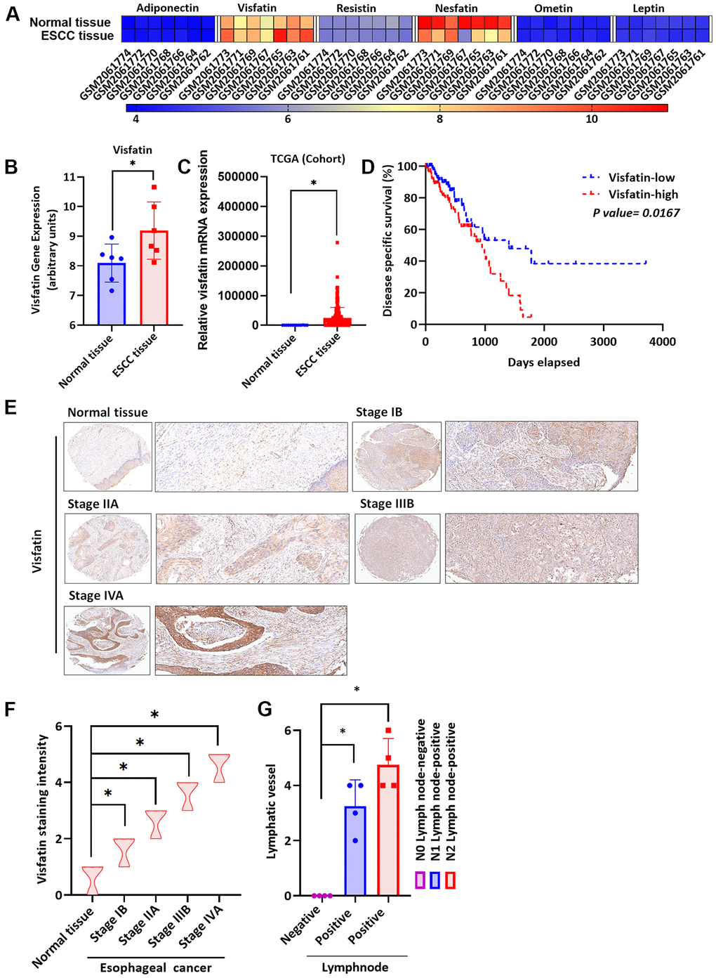 Clinicopathologic features of visfatin expression in human ESCC tissue samples. (A) The gene expression profiles of visfatin in ESCC tissue and normal tissue samples were analyzed in specimens from the GEO and TCGA databases. (B, C) Levels of visfatin were significantly increased in ESCC samples compared with normal tissue samples. (D) Kaplan-Meier analysis of overall survival according to visfatin expression in patients with esophageal cancer. (E, F) The human ESCC tissue array specimens were subjected to IHC evaluations with visfatin antibody, and levels of positive staining were quantified by IHC scoring (N = 4 per group). Scale bar: 100 μm. (G) Positive peritumoral lymphatic vessel density in patients with N0, N1, or N2 ESCC tissue array samples (N = 4 per group). *P 