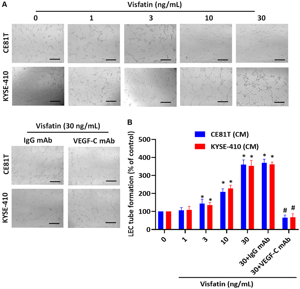 Visfatin stimulates VEGF-C-dependent lymphangiogenesis in ESCC cells. (A, B) ESCC cells were stimulated with visfatin for 24 h, or preincubated with IgG control antibody or VEGF-C antibody (1 μg/mL) for 30 min, then incubated with visfatin (30 ng/mL) for 24 h. CM was collected from each experiment and added to LECs, to examine tube formation activity. *P #P 
