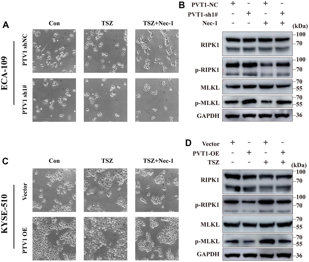 Induction of necroptotic cell death in PVT1-sh#/ PVT1-OE ESCA cells. (A) ECA-109 cells were treated with Nec-1 (50 μM) for 4 h and then treated with TSZ (30ng/ml TNF-α, 200nM Smac mimetics, 20μM zVAD). After 24 h of drug treatment, the morphological changes of treated cells were imaged under a phase-contrast microscope. (B) Western blot from ECA-109 cell was performed to detect RIP1, p-RIP1, MLKL, and p-MLKL protein levels. (C) KYSE-510 cells were treated with Nec-1 (50 μM) for 4 h and then treated with TSZ (30ng/ml TNF-α, 200nM Smac mimetics, 20μM zVAD). After 24 h of drug treatment, the morphological changes of treated cells were imaged under a phase-contrast microscope. (D) Western blot KYSE-510 cell was performed to detect RIP1, p-RIP1, MLKL, and p-MLKL protein levels.