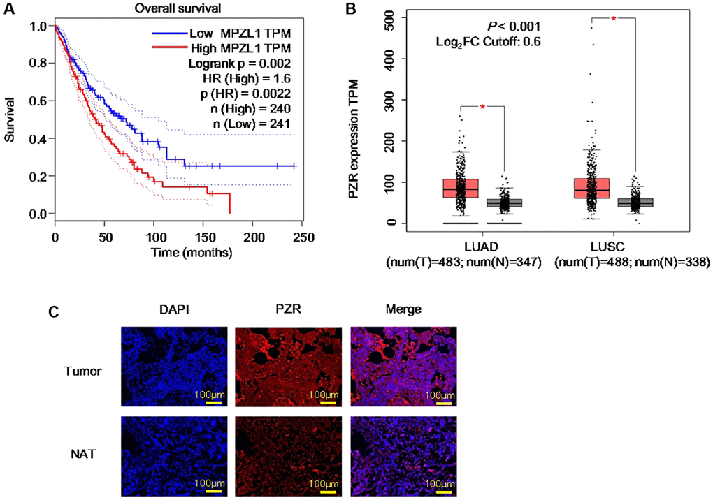 PZR represents an unfavorable prognostic biomarker and is overexpressed in lung cancer. (A) Expression data were from the TCGA databases and were analyzed by using the GEPIA tools. Overall survival analysis of TCGA lung adenocarcinoma (LUAD) and squamous cell carcinoma (LUSC) data via the GEPIA portal. (B) Comparison of PZR expression in normal and cancer lung tissues. Gene expression analysis of TCGA and GTEx databases LUAD and LUSC data via the GEPIA portal. (C) Immunofluorescent analyses PZR expression in lung cancer tissues and normal tissues adjacent to the tumor (NAT) (magnification, ×100). Data represent samples from 3 patients.