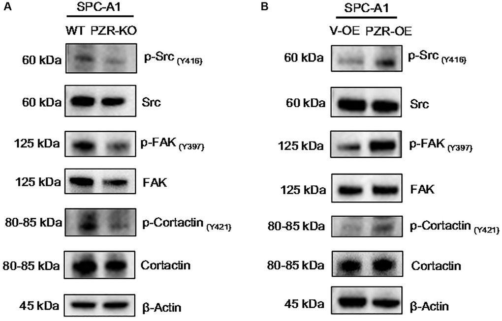 Altered expressions of PZR affect the phosphorylation of multiple proteins involved in cell adhesion and migration. Wild type (WT), PZR-knockout (PZR-KO), vector-overexpressing (V-OE), and PZR-overexpressing (PZR-OE) SPC-A1 cells were extracted in the RIPA buffer, and cells extract were subjected to Western blotting with the indicated antibodies. Note that knockout of PZR in SPC-A1 cells decreased phosphorylation of Src (Y416), FAK (Y397), and cortactin (Y421) (A) while overexpression of PZR had the opposite effects (B).