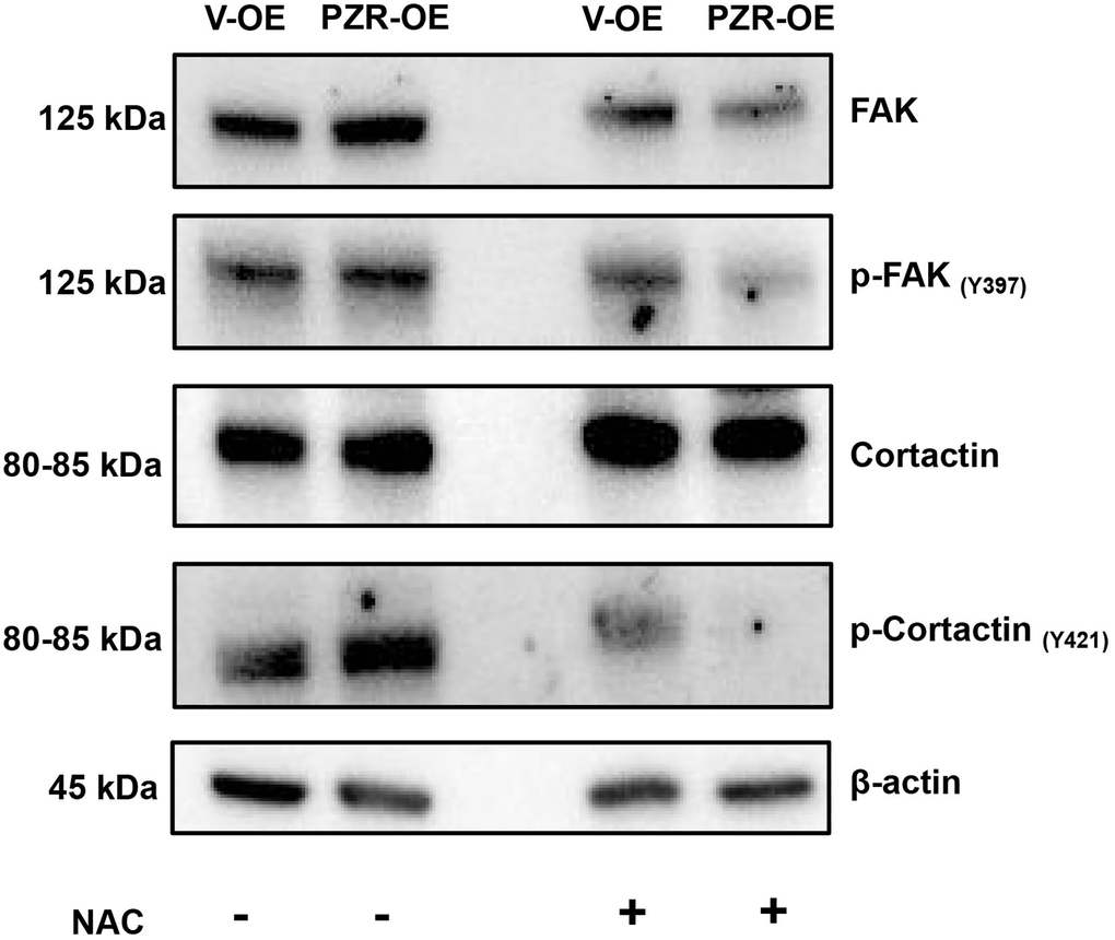ROS inhibition by NAC reduced phosphorylation of multiple proteins involved in cell adhesion and migration. Vector-overexpressing (V-OE), and PZR-overexpressing (PZR-OE) SPC-A1 cells were treated with NAC (100 μM) for 1 h and then extracted in the RIPA buffer. Cells extract were subjected to Western blotting with the indicated antibodies.