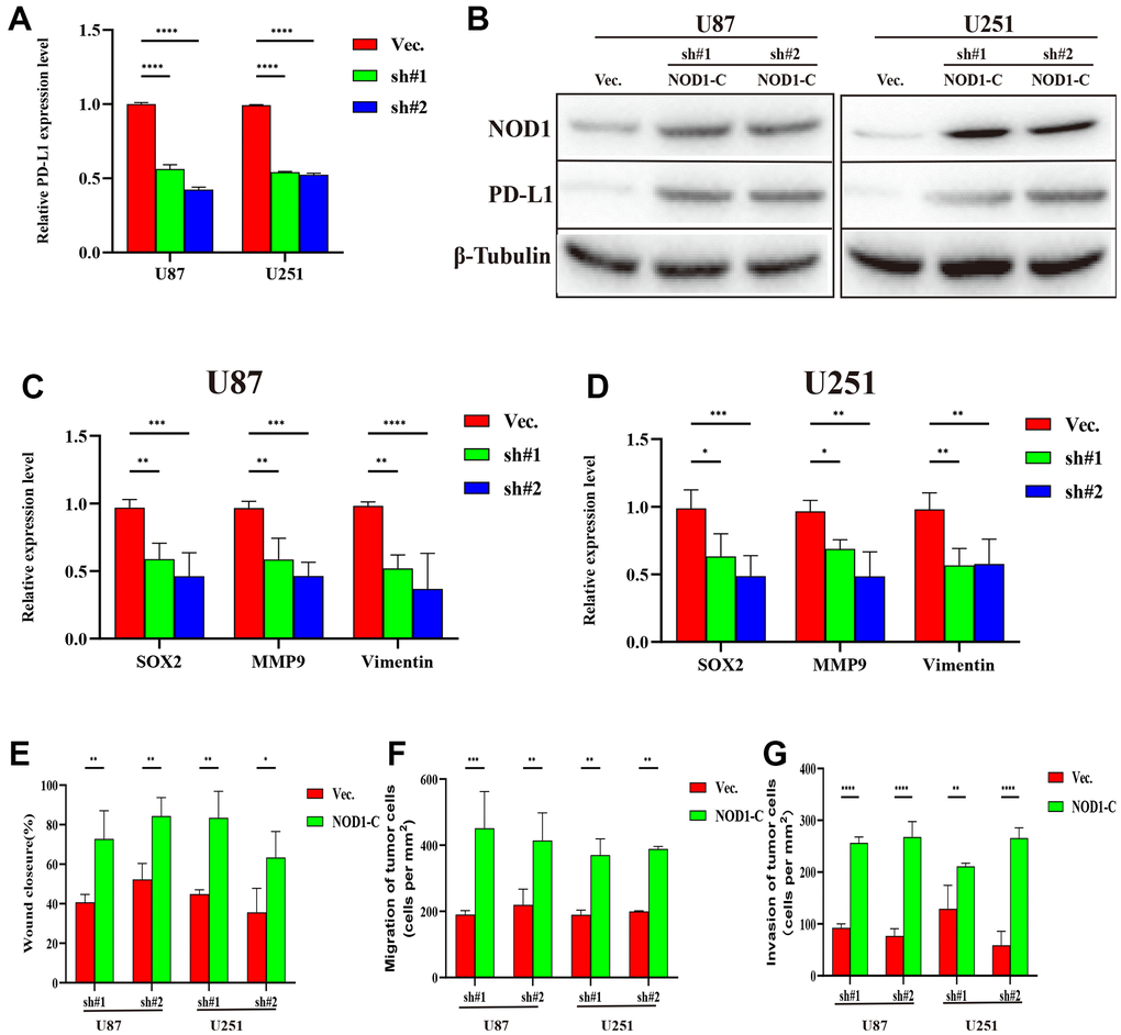 Silencing FDX1 inhibits glioma progression via the NOD1-PDL1 axis. (A) qRT-PCR shows low PDL1 expression after FDX1 silencing. (B) NOD1 and PDL1 levels are upregulated in FDX1-silenced cells after NOD1-C treatment. (C, D) Key molecules of migration decreased after FDX1 silencing. (E) Wound closure ratio elevated in FDX1-silenced cells. (F, G) Number of migrating and invading tumor cells increased in FDX1-silenced cells after NOD1-C treatment.