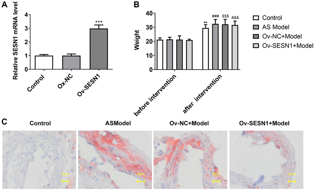 Overexpression of SESN1 inhibited plaque formation in AS mice. (A) RT-qPCR assayed the efficiency of SESN1 overexpression. ***P B) The body weight of mice. (C) Oil Red O staining was used to detect the degree of aortic plaque. **P ###P $$$P &&&P 