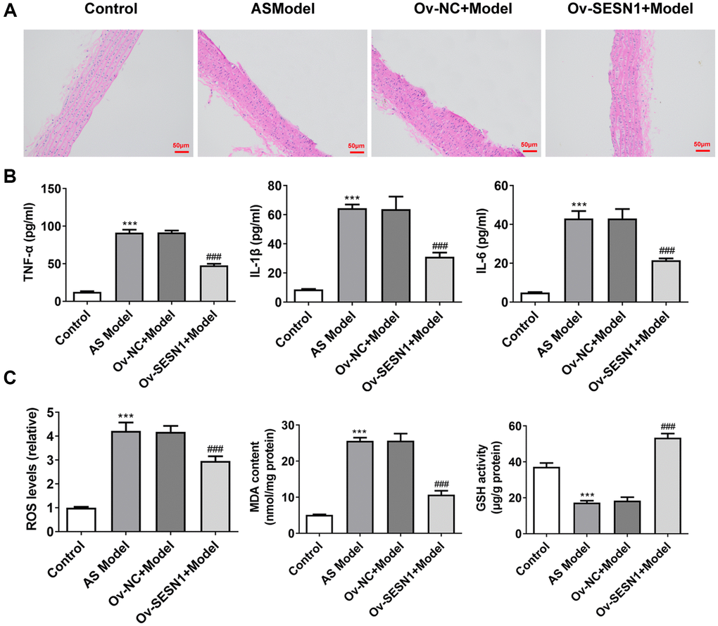 Overexpression of SESN1 inhibited inflammation and oxidative stress in AS mice. (A) The results of HE staining. (B) ELISA was used to detect the levels of inflammatory factors in vascular tissues. (C) The kits were used to detect the expression of oxidative stress-related factors ROS, MDA and GSH. ***P ###p 