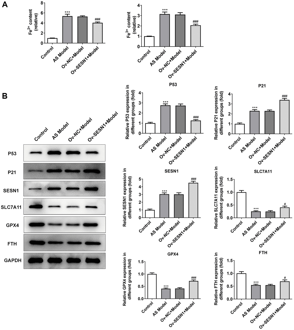 Overexpression of SESN1 inhibited ferroptosis in AS mice. (A) Immunofluorescence was used to detect the iron metabolism in vascular tissues. (B) The expressions of SESN1, P53, P21 and ferroptosis-related proteins were detected by western blot. ***P #P ###p 