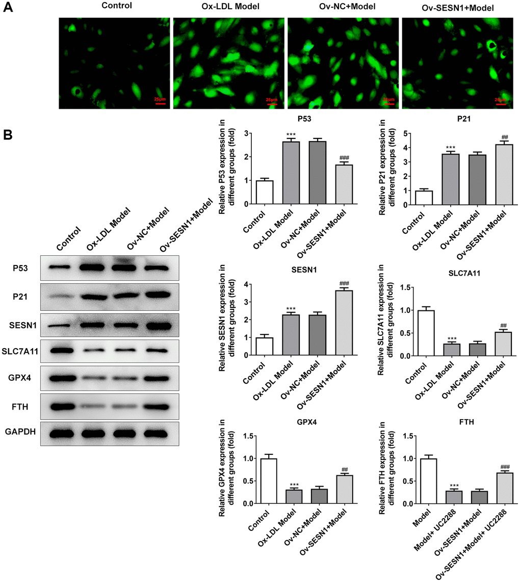 Overexpression of SESN1 inhibited ferroptosis in ox-LDL-induced HUVECs. (A) Immunofluorescence was used to detect the iron metabolism in vascular tissues. (B) The expressions of SESN1, P53, P21 and ferroptosis-related proteins were detected by western blot. ***P ##P ###p 
