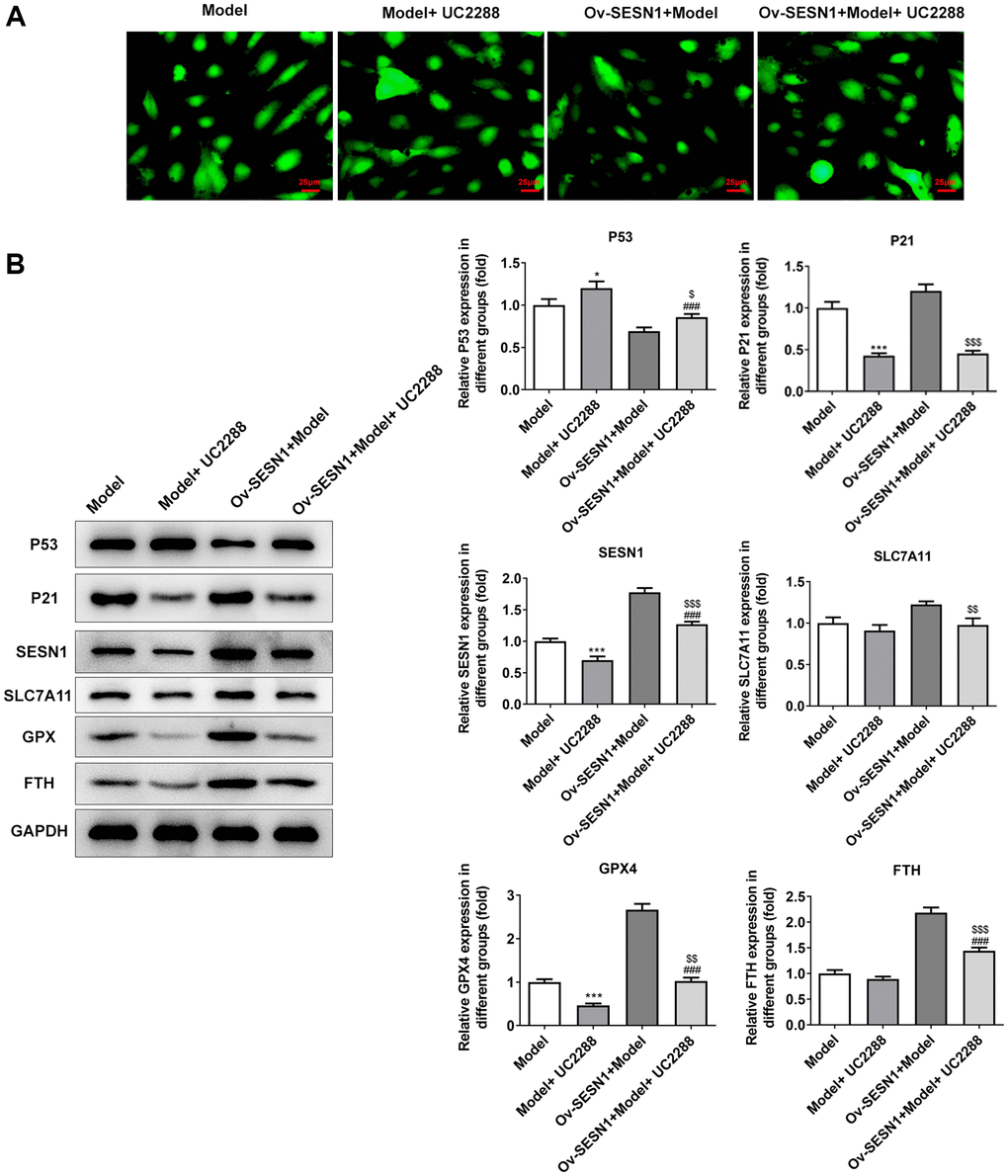Overexpression of SESN1 inhibited ferroptosis in ox-LDL-induced HUVECs via activating P21. (A) Immunofluorescence was used to detect the iron metabolism in vascular tissues. (B) The expressions of SESN1, P53, P21 and ferroptosis-related proteins were detected by western blot. *P ***P ###P $P $$P $$$P 