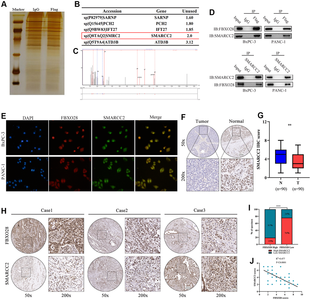 SMARCC2 is a critical target of FBXO28. (A) BxPC-3 cells with stable FBXO28 overexpression, as well as control cells, were subjected to sodium dodecyl sulfate-polyacrylamide gel electrophoresis and band staining for observation. Mass spectrometry was used to identify and isolate protein bands. (B) Liquid chromatography with tandem mass spectrometry (LC-MS/MS) analysis of five proteins co-precipitated with FBXO28. (C) Mass spectrometry revealed a unique peptide of FBXO28 identified by two-dimensional LC-MS/MS from protein lysates of anti-FBXO28 immunoprecipitated BxPC-3 cells. (D) The interaction between FBXO28 and SMARCC2 was confirmed using a co-immunoprecipitation assay, and western blots were performed on cell lysates. (E) Co-localization analysis of FBXO28 and SMARCC2 in the nucleus by immunofluorescence. (F, G) Typical immunohistochemical (IHC) image showing low expression of SMARCC2 in pancreatic cancer tissue (magnification: ×50, ×200). (H–J) Immune tissue co-expression revealed a negative association between FBXO28 and SMARCC2 expression within pancreatic cancer tissues (magnification: ×50, ×200). ****P 