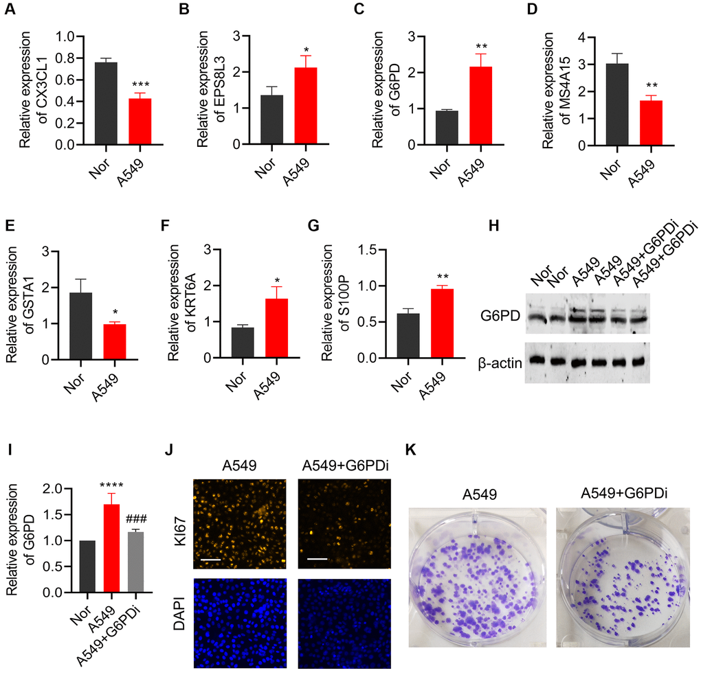 Effects of regulating G6PD on the proliferation and colony formation of lung cancer cells. The levels of (A) CX3CL1, (B) MS4A15, (C) GSTA1, (D) EPS8L3, (E) G6PD, (F) KRT6A, and (G) S100P were detected by qPCR in BEAS-2B and A549 cells. (H, I) G6PD expression in A549 cells was analyzed by Western blot after treatment with G6PDi. (J) Ki67 staining was used to assess the proliferation ability of cells after interfering with G6PD. (K) Colony formation assay was performed to detect the proliferation ability of cells after interfering with G6PD.