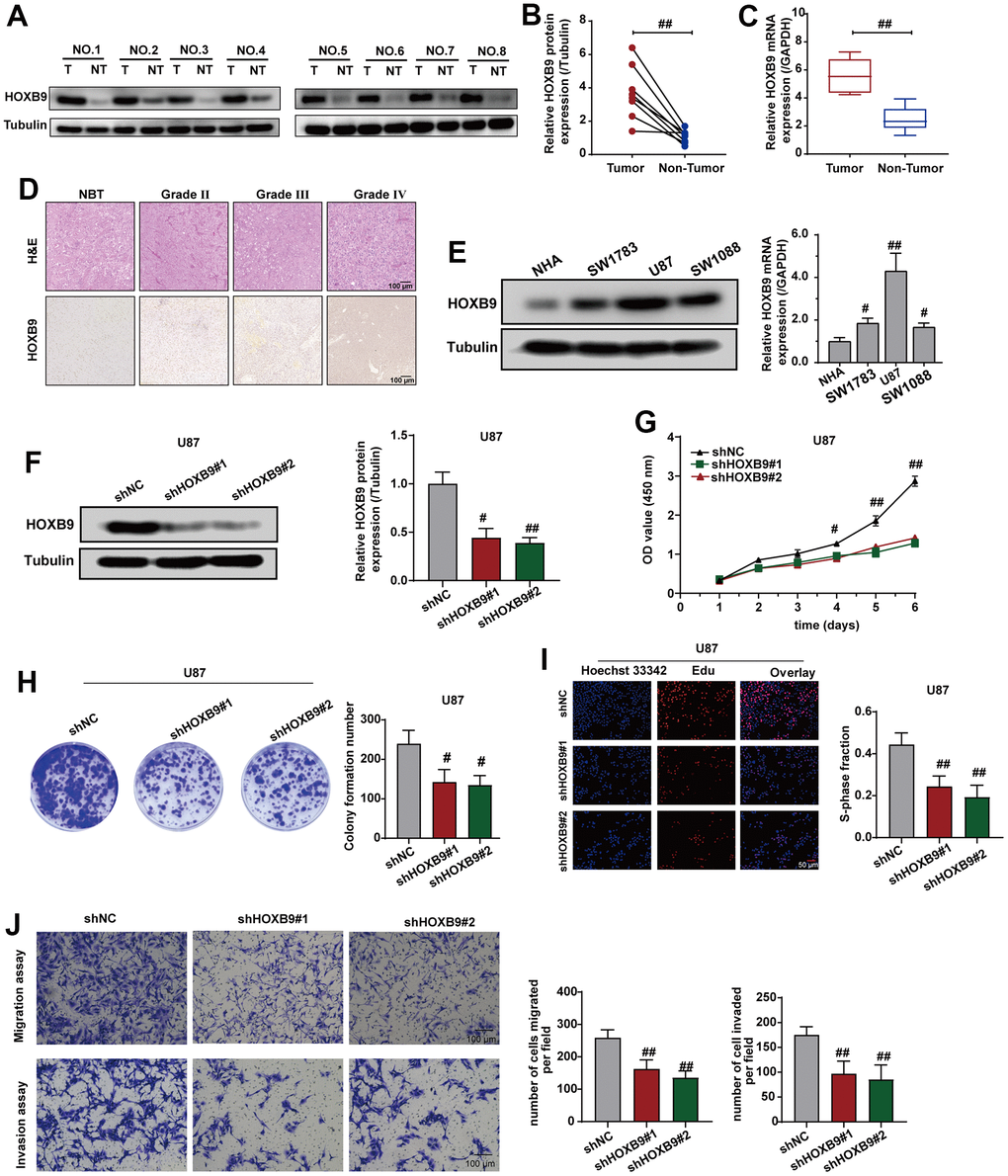 Knockdown of HOXB9 expression inhibits cells proliferation and invasion. (A) HOXB9 expression levels in GBM tissues and adjacent normal tissues. (B, C) Quantification analysis of HOXB9 protein and mRNA expression in eight paired GBM tissues and their adjacent normal tissues. (D) Representative H&E and IHC staining of HOXB9 in GBM and paired normal tissues (magnification ×200). Scale bar, 100 μm. (E) The results of western blotting and qRT-PCR detected the levels of HOXB9 expression in glioma cell lines (SW1783, U87, and SW1088) compared with normal human astrocytes (NHA). (F) The HOXB9 expression of the shHOXB9 group is less than that of the shNC group in U87 cells. (G–I) CCK-8 (G), colony formation (H), and EdU assays (I) were used to detect the proliferation ability in U87 cells transfected with shHOXB9 plasmids. (J) Transwell assays detected the migration and invasion ability in U87 cells transfected with shHOXB9 plasmids. ns > 0.05, #P ##P 