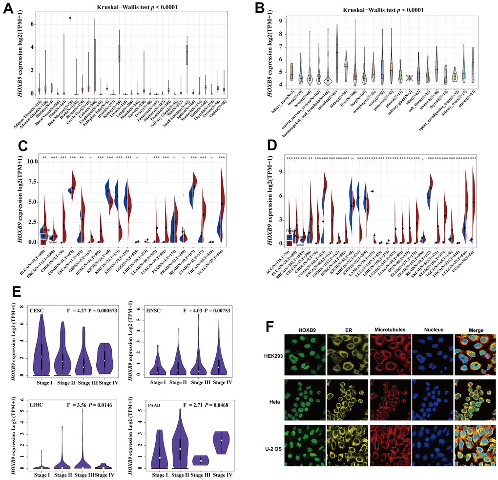 HOXB9 expression in the human pan-cancer. (A) The expression levels of HOXB9 in 31 diverse normal human tissues from the GTEx datasets. (B) The expression levels of HOXB9 in 21 diverse cancer cell lines from the CCLE database. (C) HOXB9 expression in cancers and normal tissues from TCGA database. (D) The expression levels of HOXB9 between tumor and normal tissues in each cancer are based on the integrated data from TCGA and GTEx datasets. (E) Based on the TCGA data, the expression levels of the HOXB9 gene were analyzed by the main pathological stages of CESC, HNSC, PAAD, and LIHC. (F) The immunofluorescence images of HOXB9 protein, nucleus, endoplasmic reticulum (ER), microtubules, and the merged images in HEK293, Hela, and U-2 OS cell lines. *P P P 