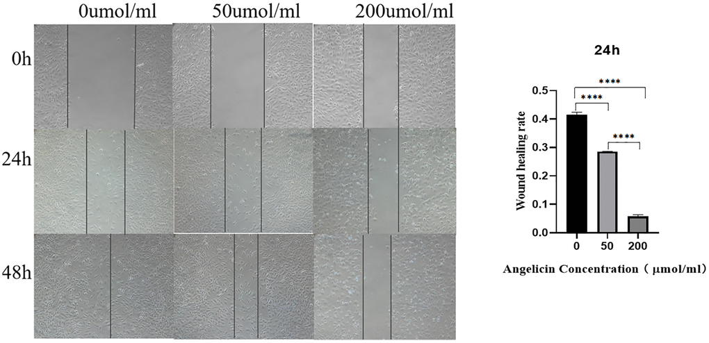 Wound healing experiment. Angelicin inhibits the migration of osteosarcoma MG63 cells. MG63 osteosarcoma cell wound healing results at different time points (0 h, 24 h, or 48 h) of culture with media containing different angelicin concentrations (0 μmol/ml, 50 μmol, or 200 μmol/ml). The results of quantitative analysis are shown as the mean ± S.D. of three independent experiments. *Significant difference between the two groups: p ****p 