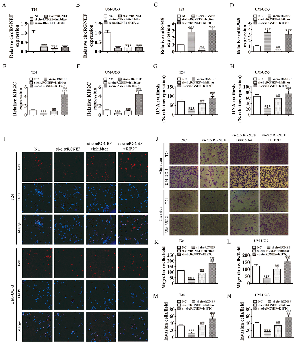 Downregulation of miR-548 or overexpression of KIF2C restored proliferation, migration, and invasion after circRGNEF silencing. (A–F) RT-qPCR shows the expression of circRGNEF (A, B), miR-548 (C, D), and KIF2C (E, F) in T24 and UM-UC-3 cells following transfection or treatment with NC, si-circRGNEF, miR-548 inhibitor, KIF2C overexpression vector (KIF2C) single or combined. Data are presented as the mean ± SD. ***P ###P G–I) Cell proliferation was analyzed by EdU assays. Data are presented as the mean ± SD. ***P ###P J–N) Cell migration and invasion were assessed in T24 and UM-UC-3 cells using Transwell assays. Data are presented as the mean ± SD. ***P ###P 