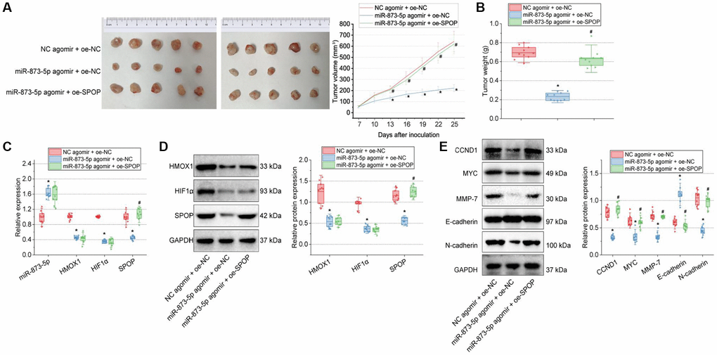 miR-873-5p inhibits the tumorigenesis of GBM cells by downregulating the HMOX1/HIF1α/SPOP signaling axis in vivo. (A) Tumor volume of nude mice. (B) Tumor weight of nude mice. (C) Expression of miR-873-5p, HMOX1, HIF1α, and SPOP in the tumor tissues of mice detected by RT-qPCR. (D) Western blot of the HMOX1, HIF1α, and SPOP proteins in the tumor tissues of mice. (E) Western blot of the CCND1, E-cadherin, MYC, MMP-7, and N-cadherin proteins in the tumor tissues of mice. n = 10. *p #p 