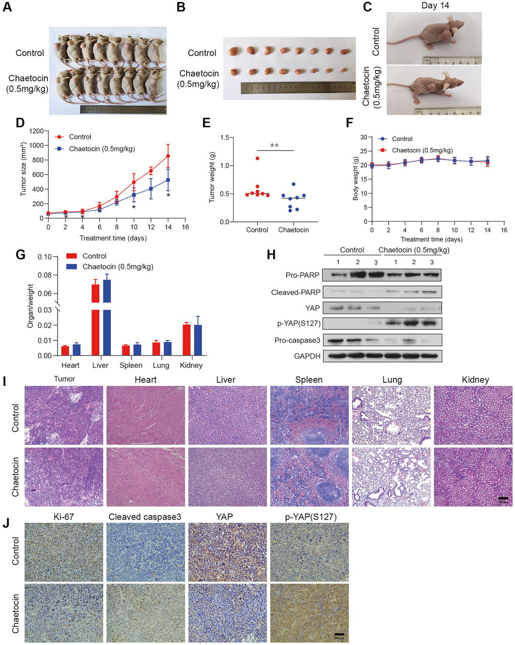 Chaetocin suppresses the growth of ESCC cell xenografts. (A) Representative photographs of a nude mouse model of xenograft tumors after control (vehicle), chaetocin (0.5 mg/kg) treatments were administered i.p. daily for 14 days. (B) Images of the tumor samples from each group. (C) The tumors of control mice and chaetocin-treated (0.5 mg/kg) mice on Day 15 are shown. (D) Tumor volumes were measured and calculated every other day. (E) Tumor mass was calculated. Error bars represent SD. ***P F) Body weight during administration of chaetocin. (G) Relative organ weights after two weeks of treatment with chaetocin. (H) Western blot was performed to detect the protein expression of PARP, Cleaved PARP, YAP, p-YAP (S127), and caspase-3 in xenograft tumor. GAPDH was used as the loading control. (I) Representative images of H&E staining for pathological examination of different tissues. (J) Immunohistochemical staining for Ki67, cleaved caspase-3, YAP and p-YAP (S127) in tumor sections. Data are expressed as mean ± SD (n = 8). *P **P 