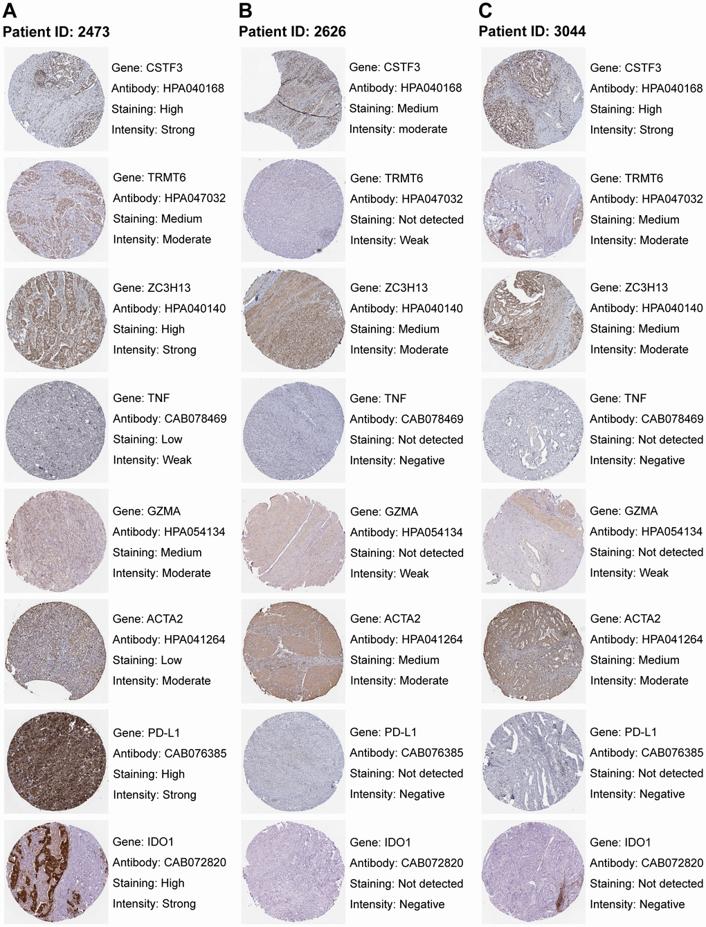 Staining patterns of RNA modification writers, immune-related genes, stromal-related genes, and immune checkpoints. (A–C) Immunohistochemical images of patient ID 2473 (A), 2626 (B), and 3044 (C). Images were downloaded from The Human Protein Atlas (HPA). Genes, antibodies, and staining degree and intensity are listed on the right of each image.