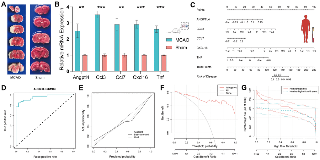Validation of HSRGs by rat MCAO model and construction of prediction model. (A) TTC staining verification of rat MCAO model. (B) Validation of quantitative real-time PCR analysis. (C) Nomogram of HSRGs for predicting IS. A calibration curve (D), Clinical decision analysis (E, F), and ROC curve (G) of the nomogram.