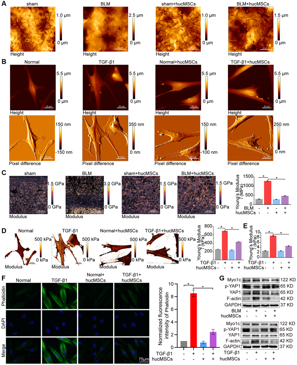 hucMSCs treatment weakened mechanical stiffness in pulmonary fibrosis. (A) AFM images showed that the surface of lung tissues was smooth in the sham group. BLM caused the lung surface to become rough and increased the lung tissue thickness. hucMSCs treatment improved lung tissue morphology. (B) AFM images displayed that the cells were spindle shaped with smooth surface in the normal group. After TGF-β1 stimulation, the cells became elongated and flat and their cell height/roughness increased. hucMSCs treatment improved the cell state. Stress fibers arranged in parallel along the main axis of cells were found in the TGF-β1 group. After hucMSCs intervention, these fibers were reduced. (C) Young’s modulus value increased in the BLM group compared with that in the sham group, and hucMSCs treatment decreased the Young’s modulus. The average Young’s modulus was 299.017 ± 21.021 MPa in the sham group, 1275.667 ± 89.502 MPa in the BLM group, 284.667 ± 18.778 MPa in the sham+hucMSCs group, and 471.183 ± 29.462 MPa in the BLM+hucMSCs group. (D) Young’s modulus increased in the TGF-β1 group compared with that in the normal group, and hucMSCs treatment decreased the Young’s modulus. The average Young's modulus was 254.583 KPa in the normal group, 697.217 KPa in the TGF-β1 group, 238.150 KPa in the normal+hucMSCs group, and 434.150 KPa in the TGF-β1+hucMSCs group. (E) Tests using colloid probe with ball stuck pressed cells were conducted to determine the reaction forces of cells based on Young’s modulus. The average Young’s modulus was 2.686 ± 0.349 KPa in the normal group, 8.742 ± 0.422 KPa in the TGF-β1 group, 2.660 ± 0.333 KPa in the normal+hucMSCs group, and 4.623 ± 0.349 KPa in the TGF-β1+hucMSCs group. (F) Cytoskeleton staining with FITC-phalloidin depicted that the cytoskeleton tension was aggravated by TGF-β1 treatment and alleviated by hucMSCs treatment. (G) hucMSCs treatment decreased YAP1, Myo1c, and F-actin expression and increased p-YAP1 expression in BLM-induced mice model and TGF-β1-activated cell model. Each bar represents the mean ± SD; n = 6; *p 