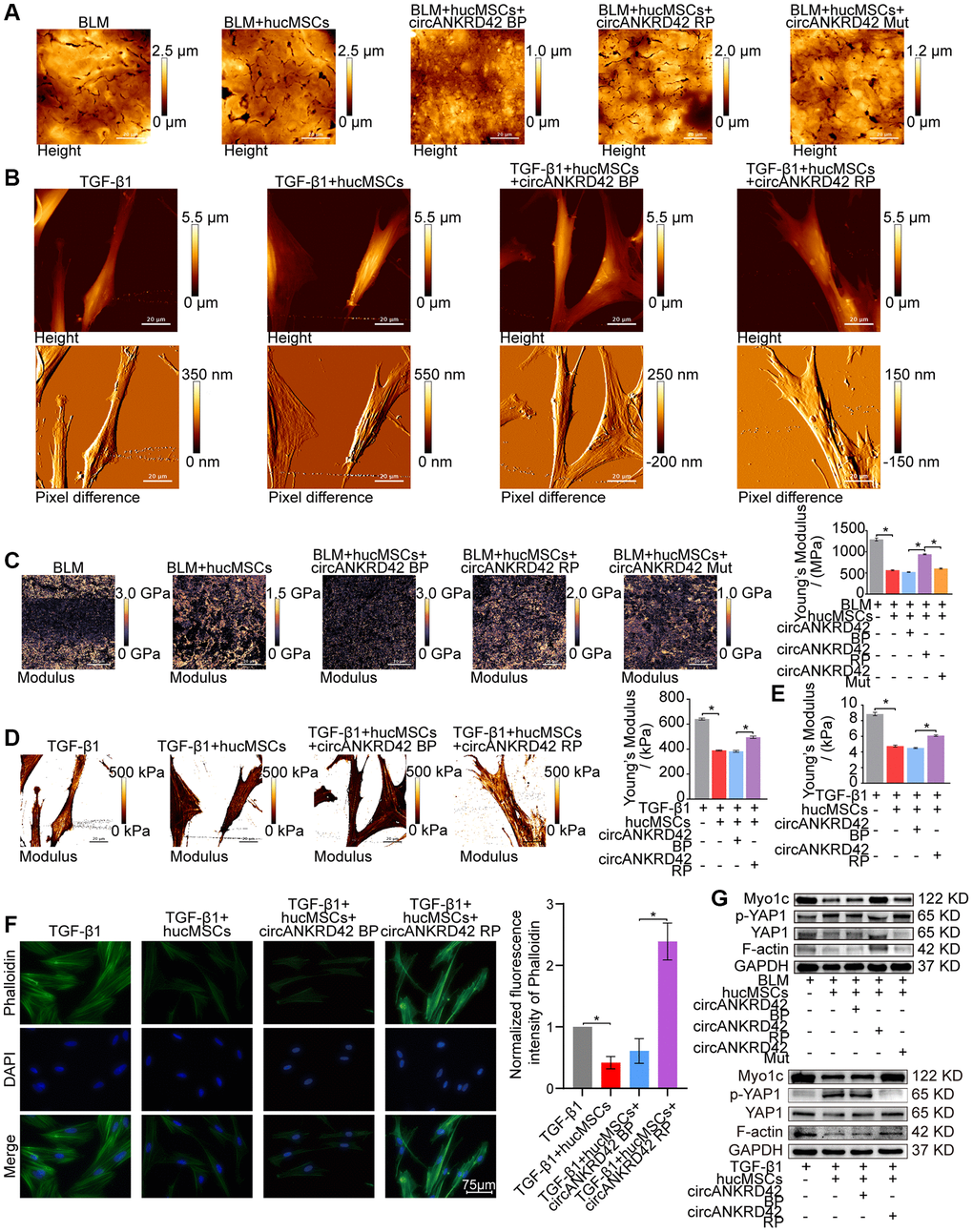 Rescue experiments proved that hucMSCs treatment reduced mechanical stiffness by regulating circANKRD42–miR-136-5p–YAP1 signal pathway in vivo and in vitro. (A) AFM images depicted that BLM caused the roughness of the lung surface and the thickening of the lung tissues. hucMSCs treatment improved the lung tissue morphology, but this therapeutic effect was reversed by overexpressed circANKRD42. The effect of circANKRD42 mutation was weaker than that of overexpressed circANKRD42. (B) In the TGF-β1 group, the cells became slender and flat. Stress fibers arranged in parallel along the main axis of cells were observed in the group. In the hucMSCs-treated group, the cell shape significantly retracted and the corresponding fibers were reduced. Overexpressed circANKRD42 reversed the effect of hucMSCs treatment on cells. (C) Young’s modulus measurement showed that hucMSCs treatment decreased the force compared with that in the BLM group, but overexpressed circANKRD42 reversed the effect of hucMSCs treatment on the force. The effect of circANKRD42 mutation on the force was weaker than that of overexpressed circANKRD42. The measured average Young’s modulus was 1291.667 ± 82.735 MPa in the BLM group, 563.833 ± 31.822 MPa in the BLM+hucMSCs group, 520 ± 20.460 MPa in the BLM+hucMSCs+circANKRD42 BP group, 942.05 ± 28.203 MPa in the BLM+hucMSCs+circANKRD42 RP group, and 604.233 ± 29.259 MPa in BLM+hucMSCs+circANKRD42 Mut. (D) Young’s modulus measurement revealed that hucMSCs treatment decreased the force compared with that in the TGF-β1 group, but overexpressed circANKRD42 reversed the effect of hucMSCs treatment on the force. The measured average Young's modulus was 641.167 KPa in the TGF-β1 group, 389.467 KPa in the TGF-β1+hucMSCs group, 382.767 in the TGF-β1+hucMSCs+circANKRD42 BP group, and 495.433 KPa in TGF-β1+hucMSCs+circANKRD42 RP. (E) Young’s modulus measurement showed that hucMSCs treatment decreased the reaction forces of cells compared with that in the TGF-β1 group, but overexpressed circANKRD42 reversed the effect of hucMSCs treatment on the force. The measured average Young's modulus was 8.858 ± 0.526 KPa in the TGF-β1 group, 4.756 ± 0.306 KPa in the TGF-β1+hucMSCs group, 4.504 ± 0.160 KPa in the TGF-β1+hucMSCs+circANKRD42 BP group, and 6.092 ± 0.240 KPa in TGF-β1+hucMSCs+circANKRD42 RP. (F) Cytoskeleton staining with FITC-phalloidin depicted that cytoskeleton tension was weakened by hucMSCs treatment but enhanced by circANKRD42 overexpression. (G) hucMSCs treatment inhibited the expression levels of YAP1, Myo1c, and F-actin and increased p-YAP1 expression in vivo and in vitro. circANKRD42 overexpression increased the expression of YAP1, Myo1c, and F-actin and decreased p-YAP1 expression, thus reversing the effect of hucMSCs treatment in vivo and in vitro. The effect of circANKRD42 mutation was weaker than that of overexpressed circANKRD42. Each bar represents the mean ± SD; n = 6; *p 