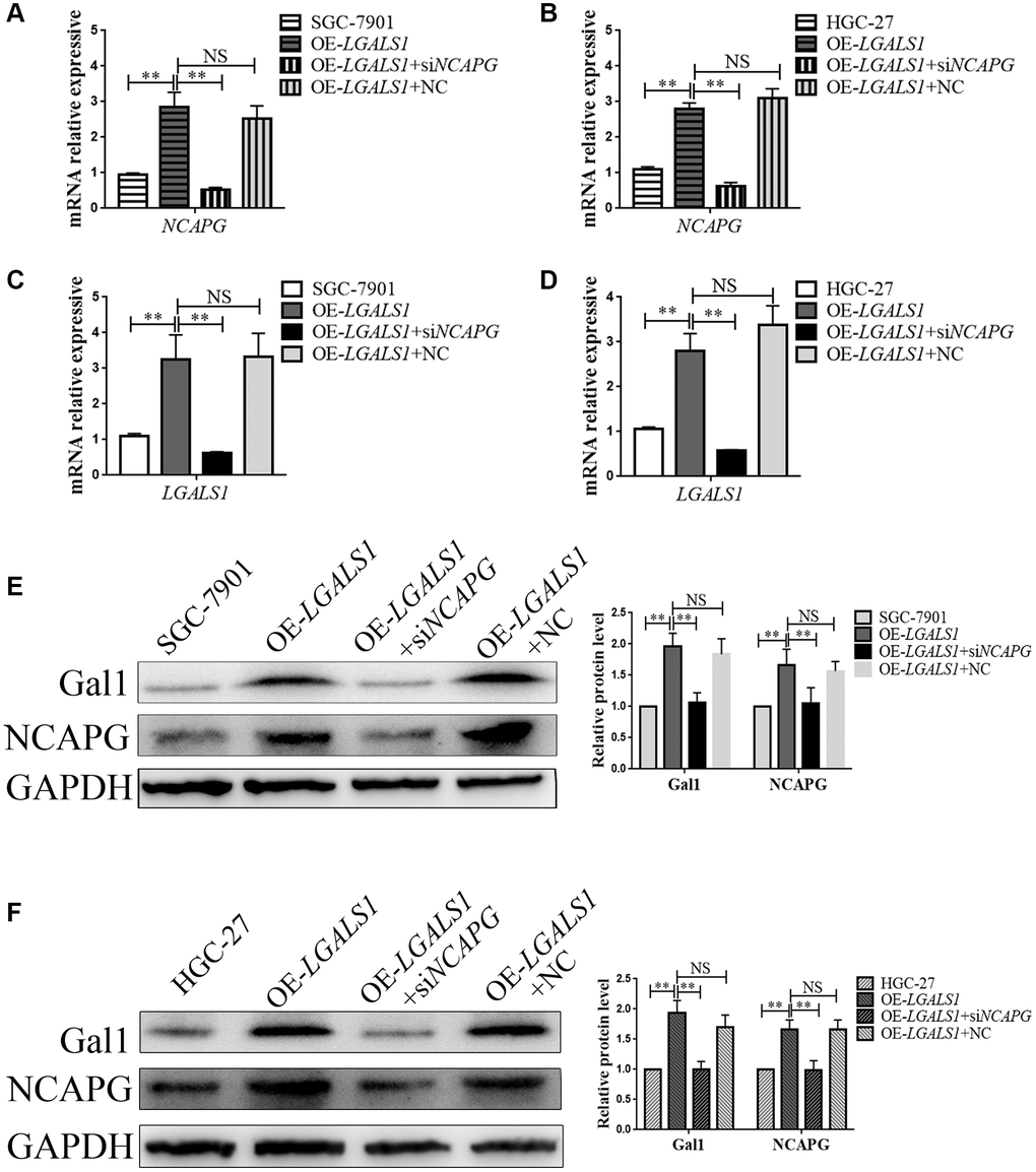 LGALS1 and NCAPG may mutually reinforce regulation in GC cell lines. qRT-PCR analysis of (A, B) NCAPG and (C, D) LGALS1 expression in SGC-7901 and HGC-27 cells when LGALS1 was overexpressed, with or without simultaneous silencing of NCAPG. Western blot confirmation of stable overexpression of Gal1 and NCAPG in (E) SGC-7901 and (F) HGC-27 cells when LGALS1 was overexpressed, with or without simultaneous silencing of NCAPG. Abbreviations: OE-LGALS1: Overexpression of LGALS1; siNCAPG: silencing of NCAPG; OE-LGALS1+NC: overexpression of LGALS1 + NCAPG negative control (empty vector); NS: not significant. *P **P 
